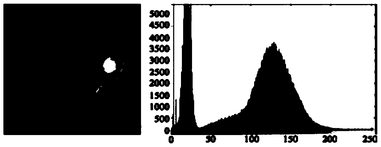 A method for screening fundus images