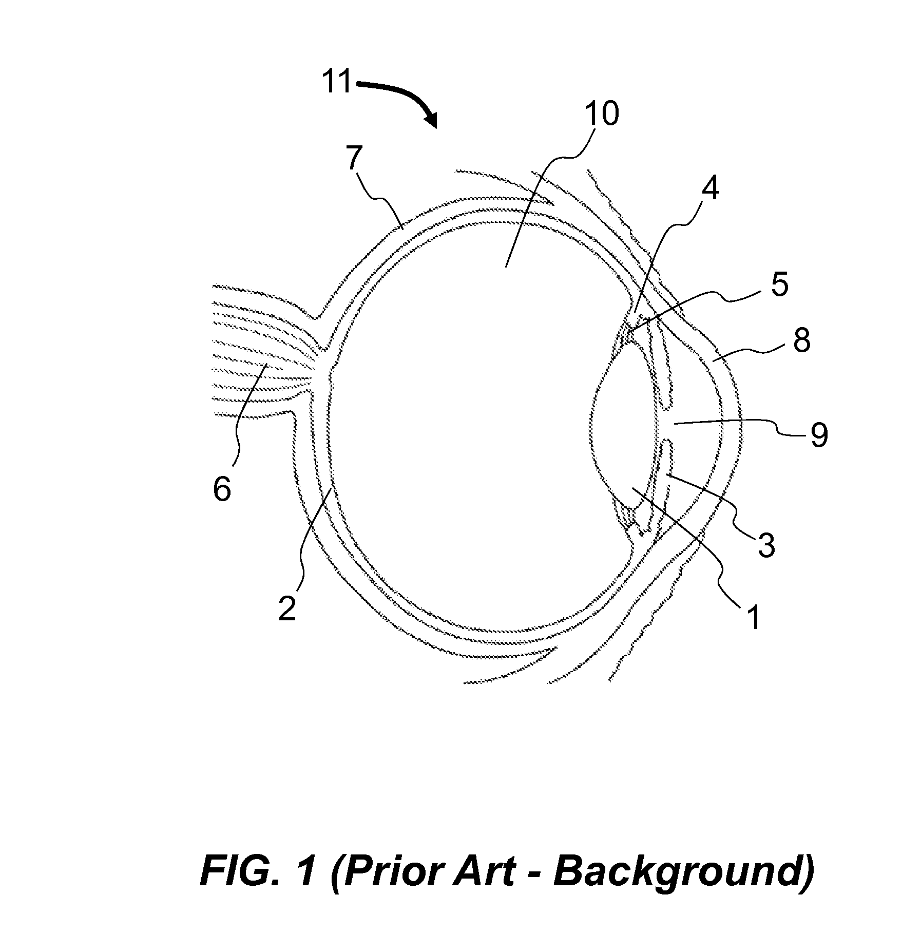 Method and apparatus to project image on retina at various focal depths utilizing flexible substrate containing optical array