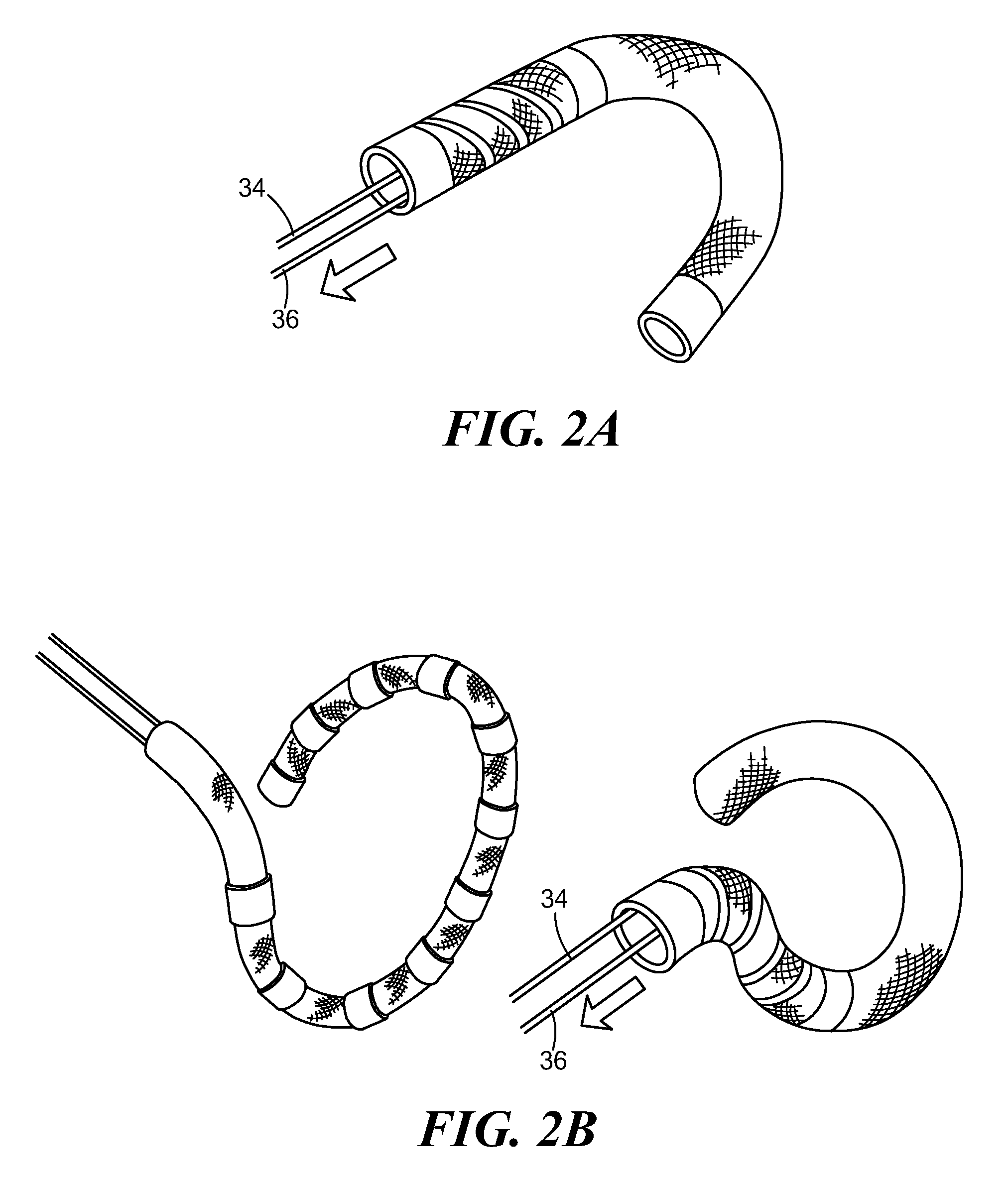 Bi-modal linear and loop ablation catheter, and method