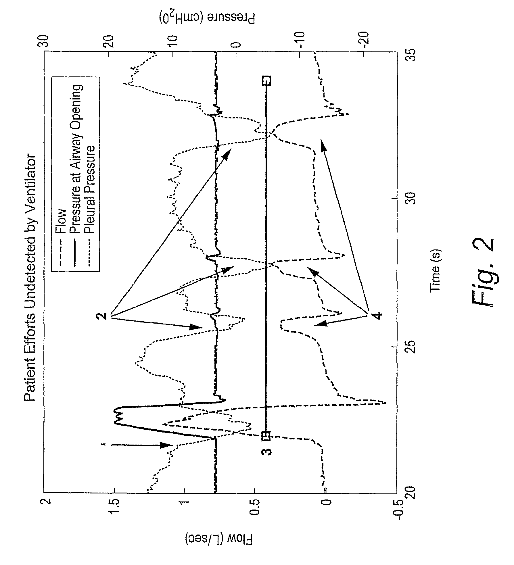 Method and apparatus for detecting ineffective inspiratory efforts and improving patient-ventilator interaction