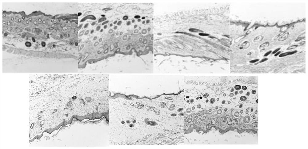 Traditional Chinese medicine composition for treating atopic dermatitis, and preparation method and application thereof