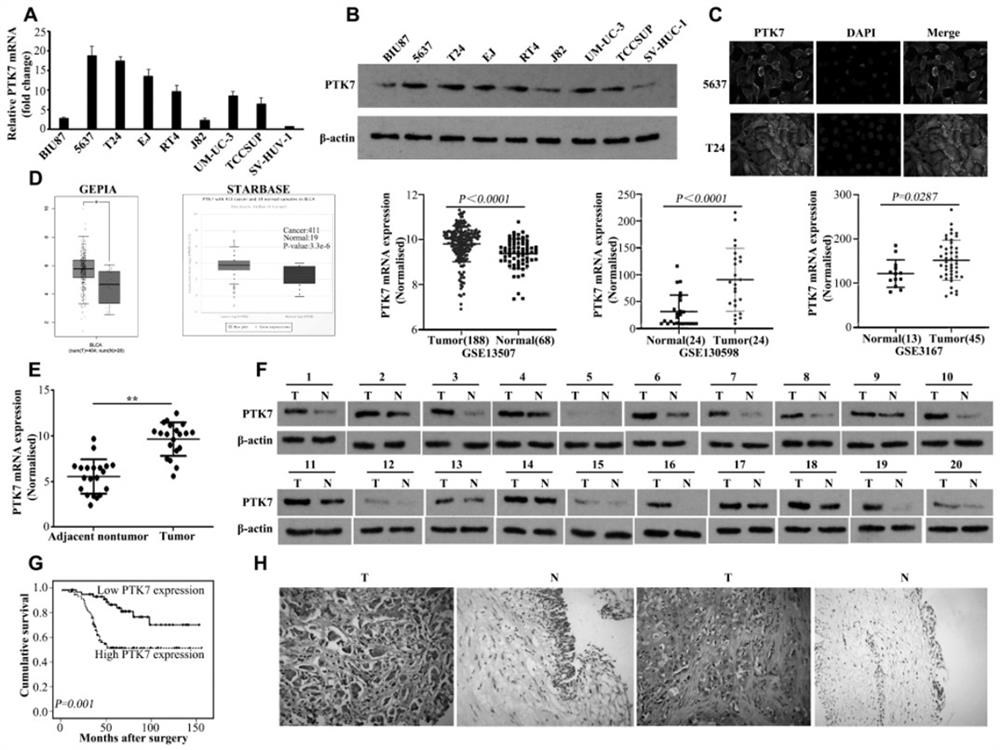 Application of nucleic acid aptamer-drug conjugate PTK7-GEMs in preparation of drug for treating bladder cancer