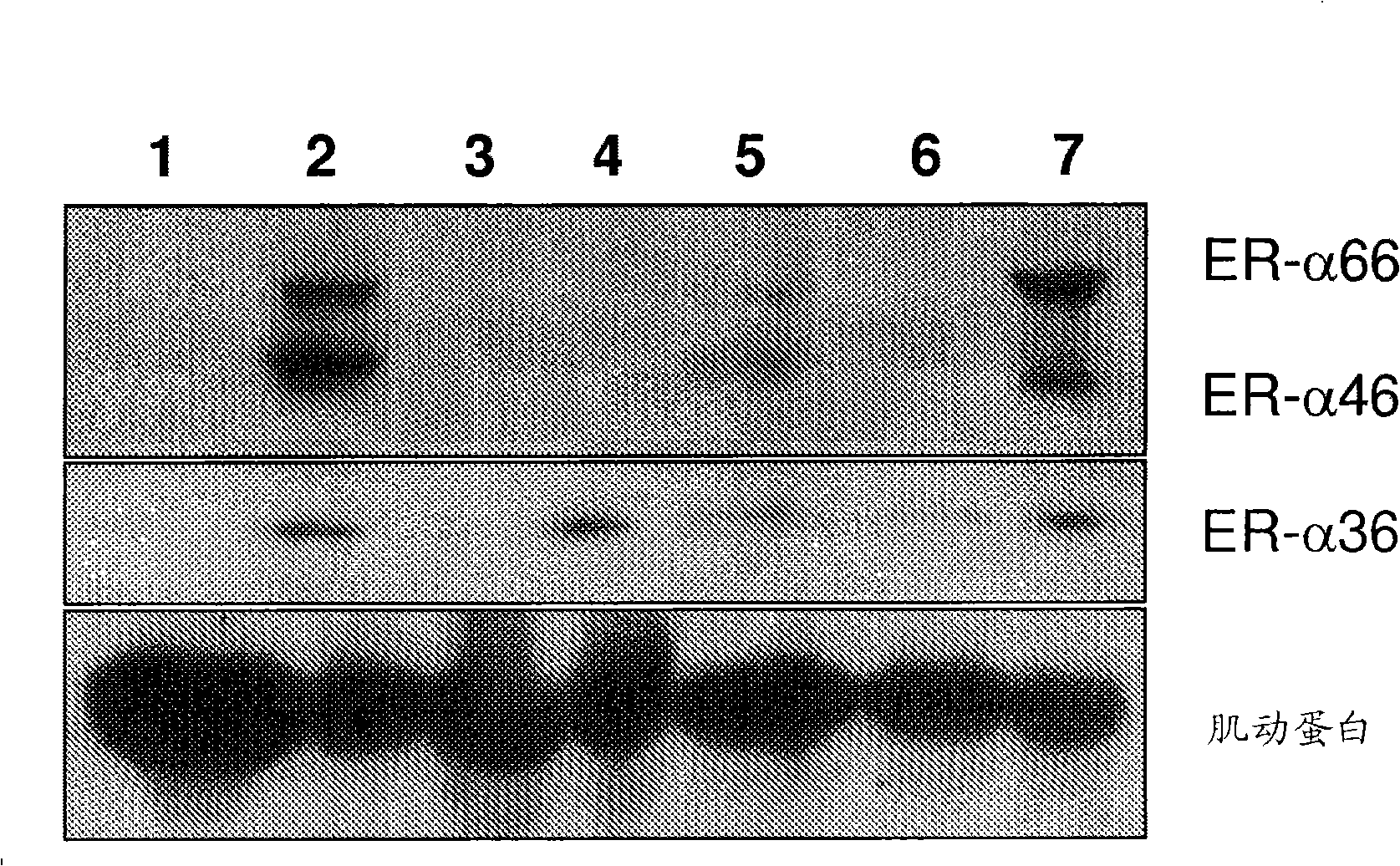Compounds and methods for treating estrogen receptor-related diseases