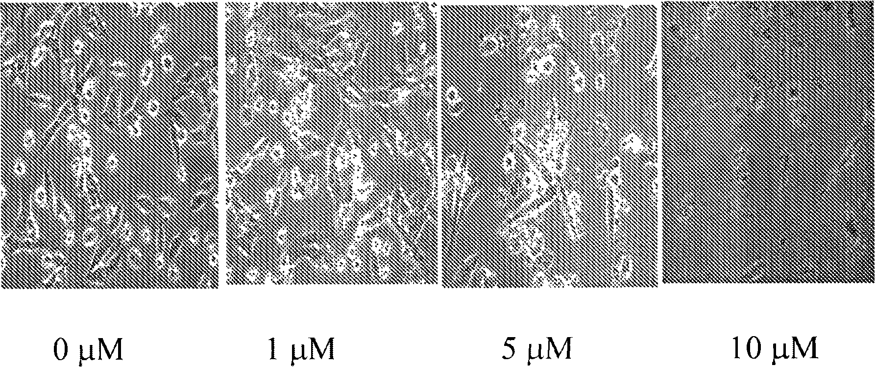 Compounds and methods for treating estrogen receptor-related diseases