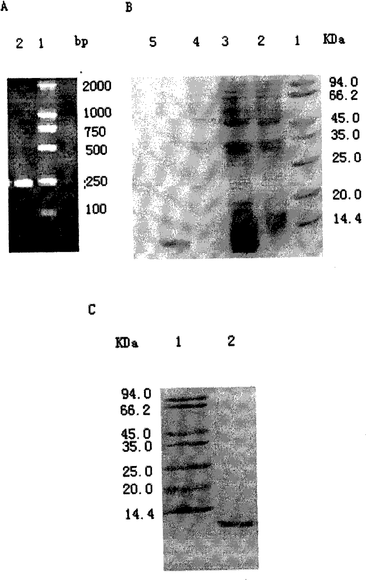 Preparation of human SDF-1 alpha, human SDF-1 alpha obtained therefrom and use thereof
