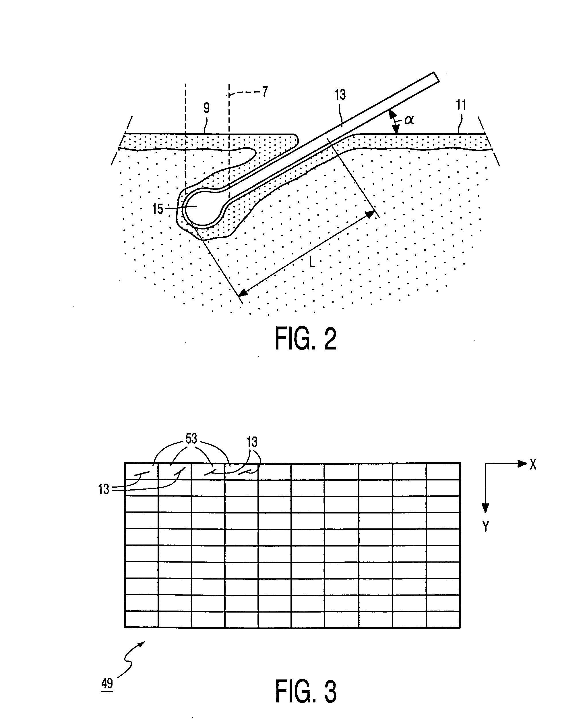 Hair-removing device with a controllable laser source