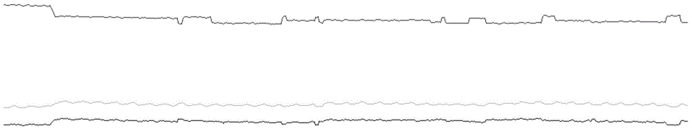 Non-contact physiological parameter detection method, system and device