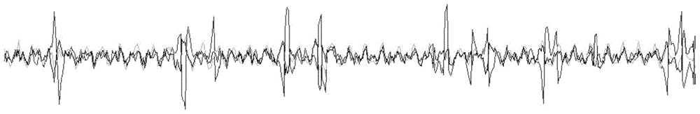 Non-contact physiological parameter detection method, system and device