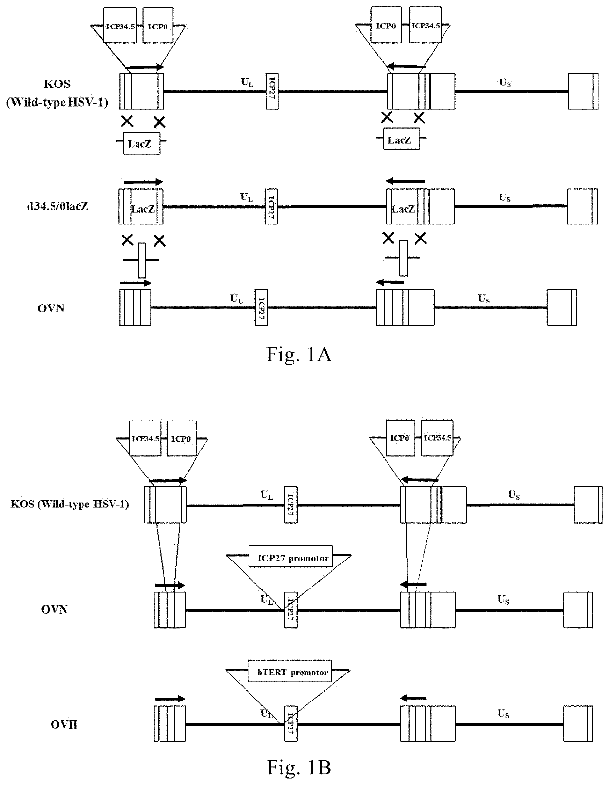 Recombinant herpes simplex virus and use thereof