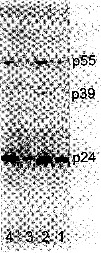 Monoclonal antibody of anti human immune deficiency virus I type 24 protein and application thereof
