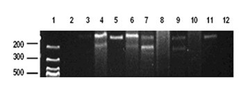 Application of lychee seed flavonoids compounds in terms of preparation of medicine for treating herpes simplex virus encephalitis