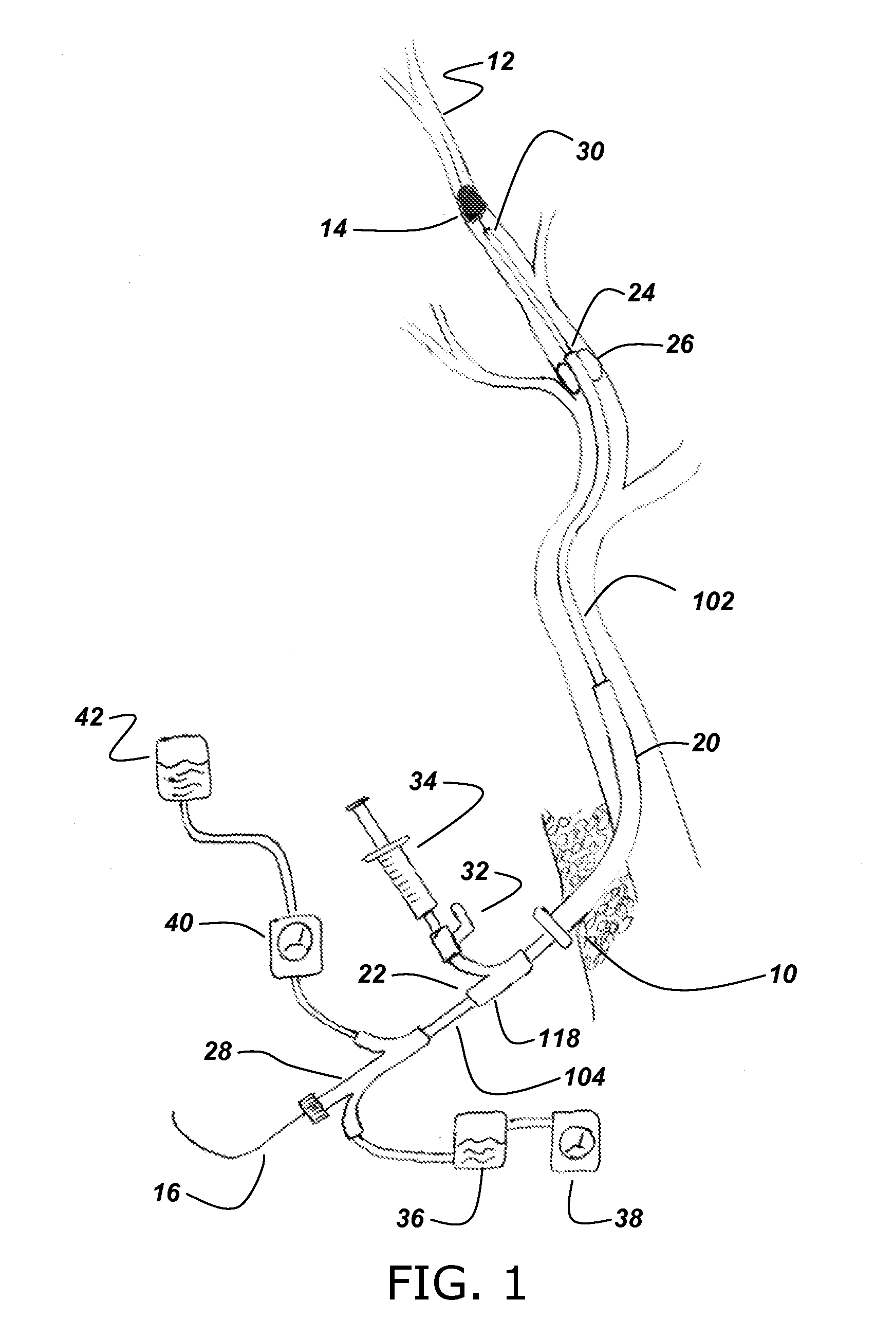 Neurovascular microcatheter device, system and methods for use thereof
