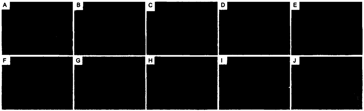 Preparation of zinc linolenate and application thereof in preparation of drugs for resisting helicobacter pylori