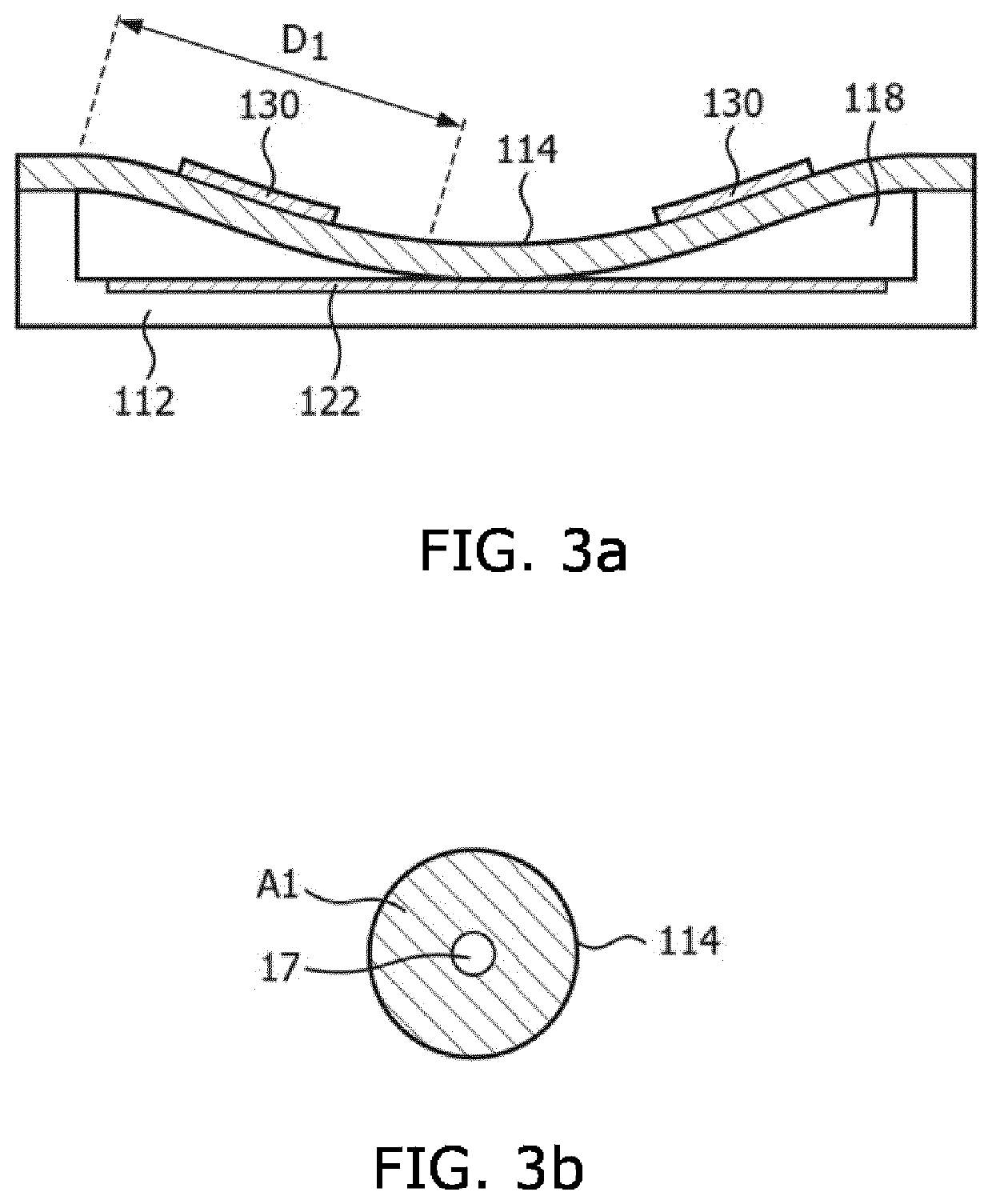 Ultrasound system and method