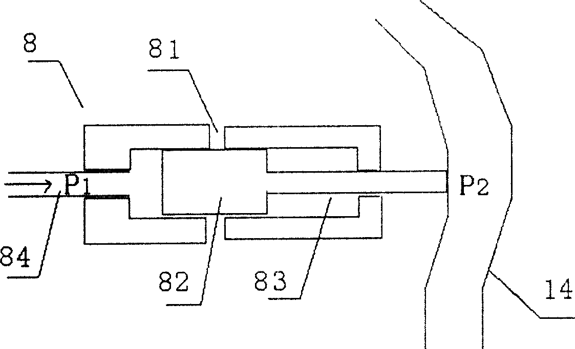 Non-wound esophageal varix venous pressure analyser