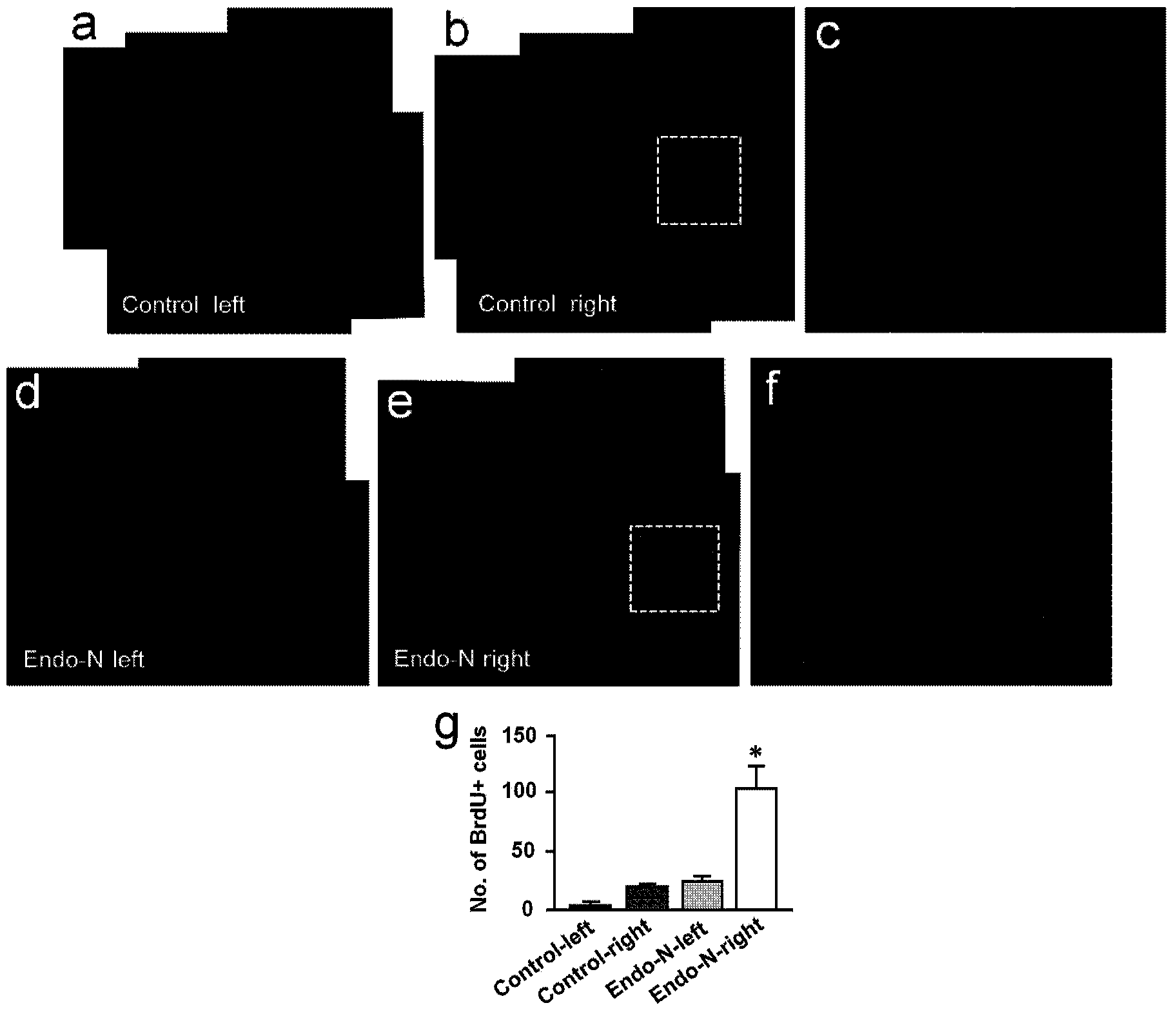 Method for studying migration, proliferation and differentiation of brain endogenous neural stem cells