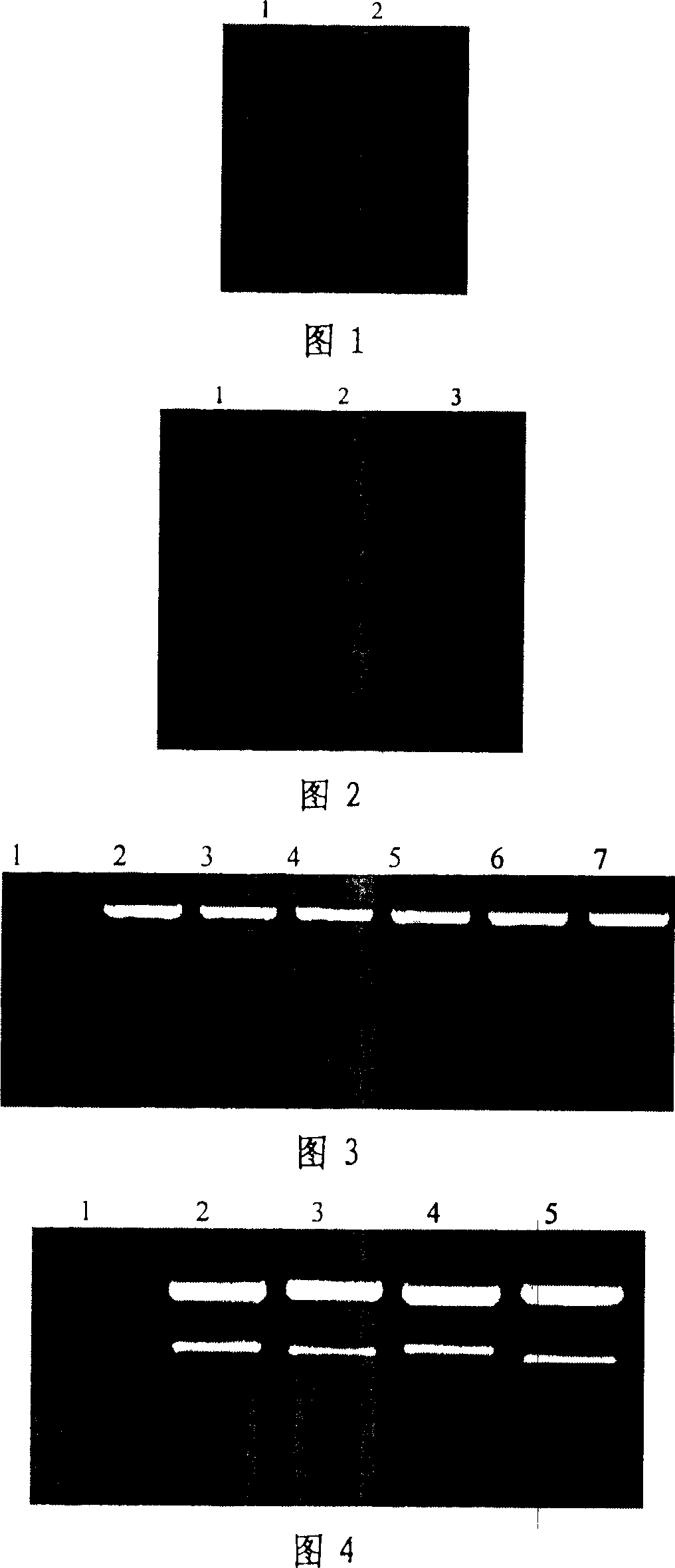 Immune tbid gene and its coded protein and application