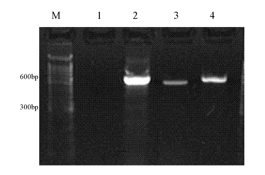 Fungus colony polymerase chain reaction (PCR) method and pathogenic fungus identification method