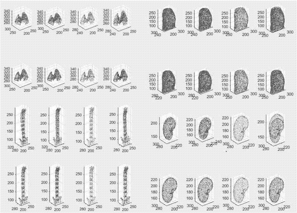 Mouse CT image kidney segmentation method based on random forest and statistic model