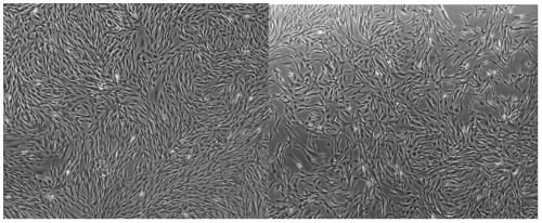 A kind of preparation method of clinical grade placental mesenchymal stem cells