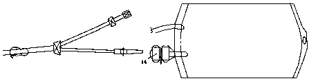 A new type of cell cryopreservation bag meeting the requirements of aseptic operation and its application method