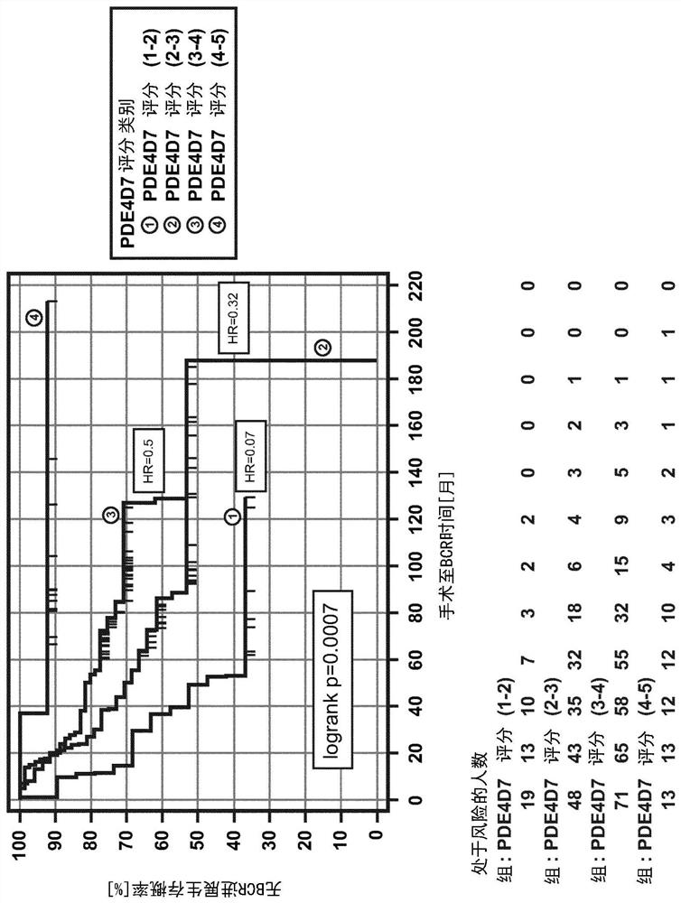 Pre-surgical risk stratification based on pde4d7 expression and pre-surgical clinical variables