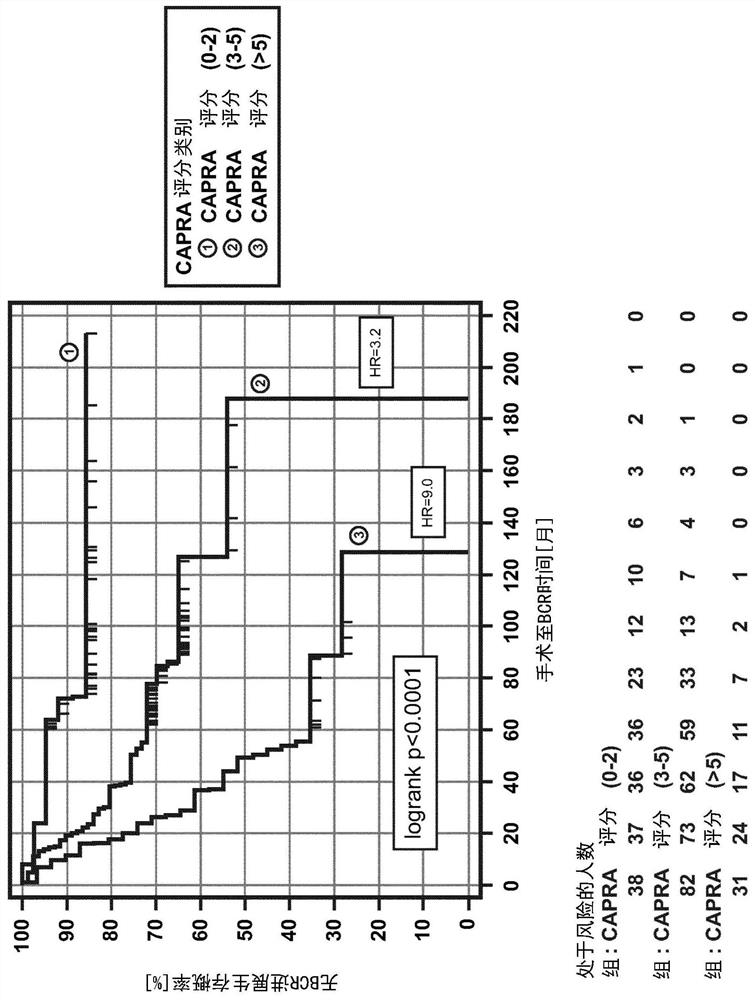 Pre-surgical risk stratification based on pde4d7 expression and pre-surgical clinical variables