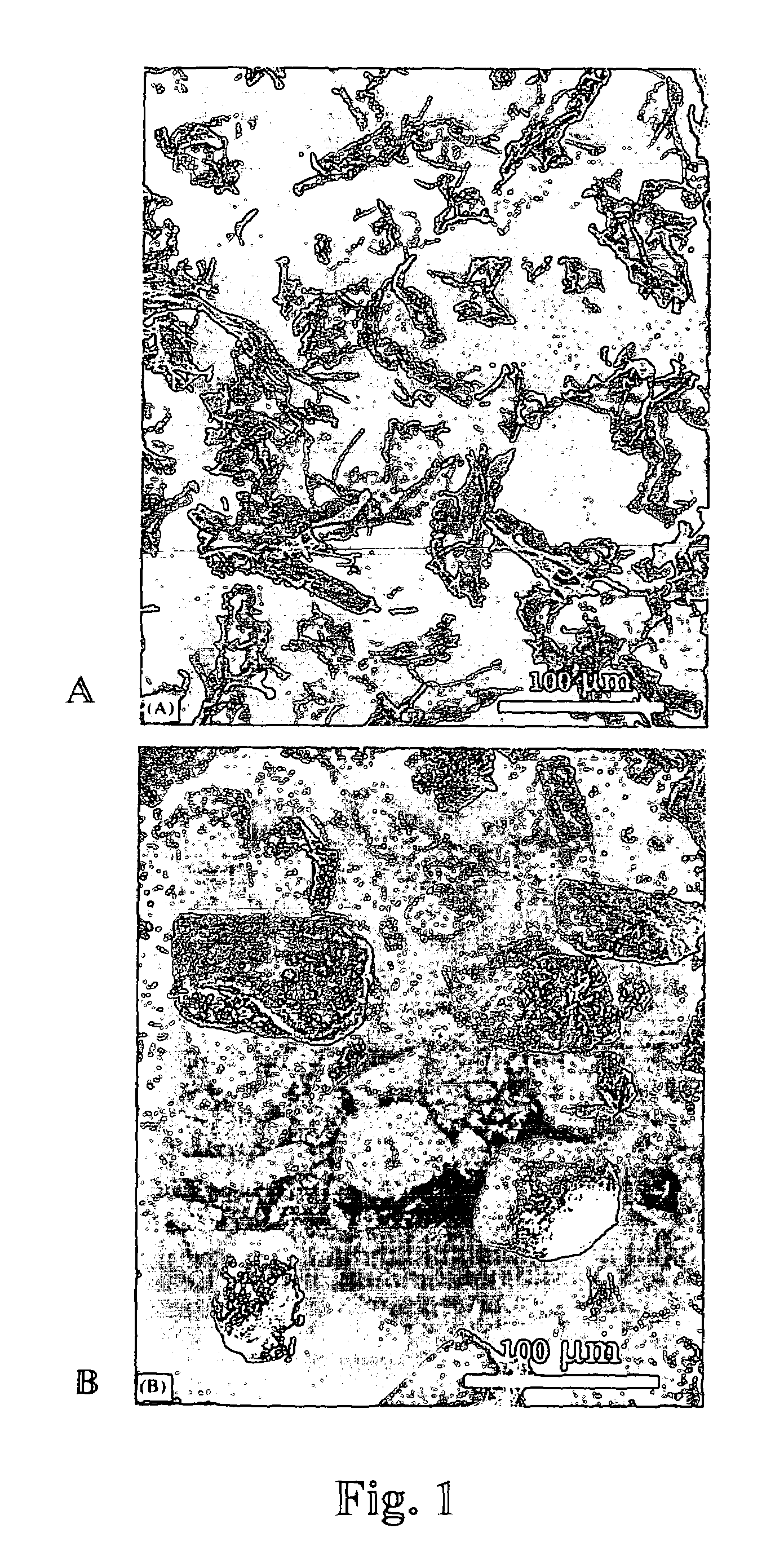 Porous polymeric matrices made of natural polymers and synthetic polymers and optionally at least one cation and methods of making