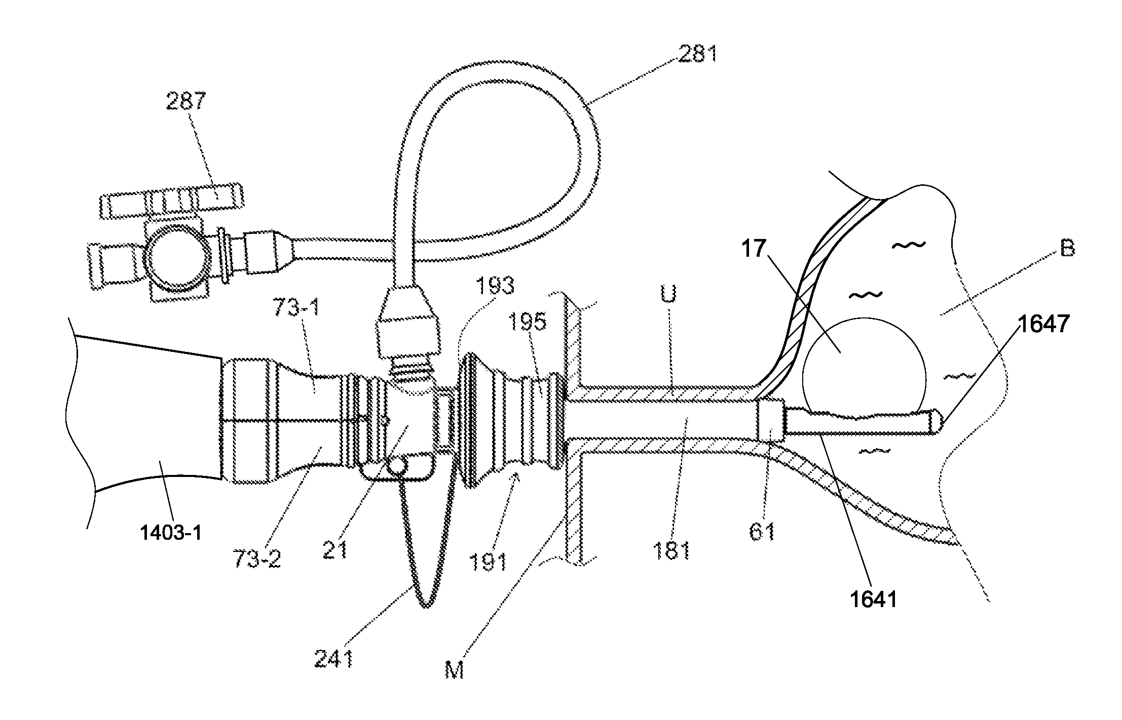 Methods and systems for performing a medical procedure