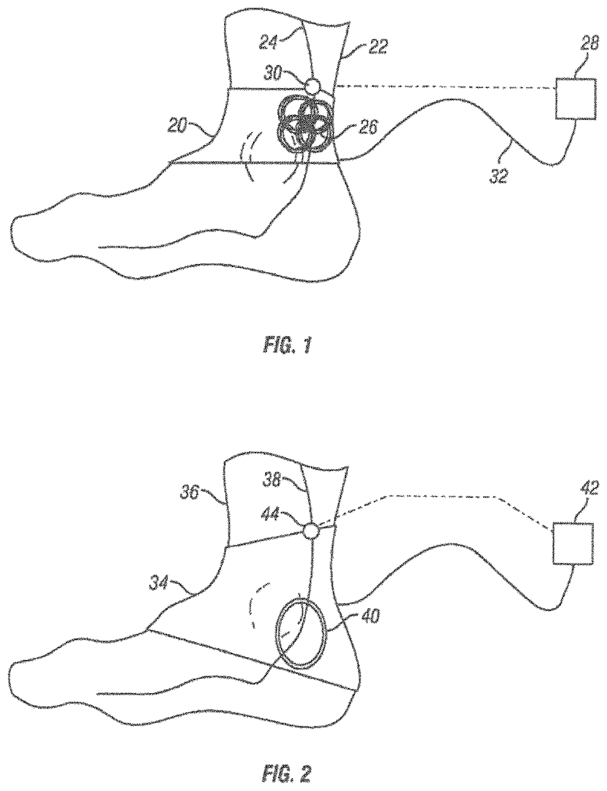 Method and apparatus for transdermal stimulation over the palmar and plantar surfaces