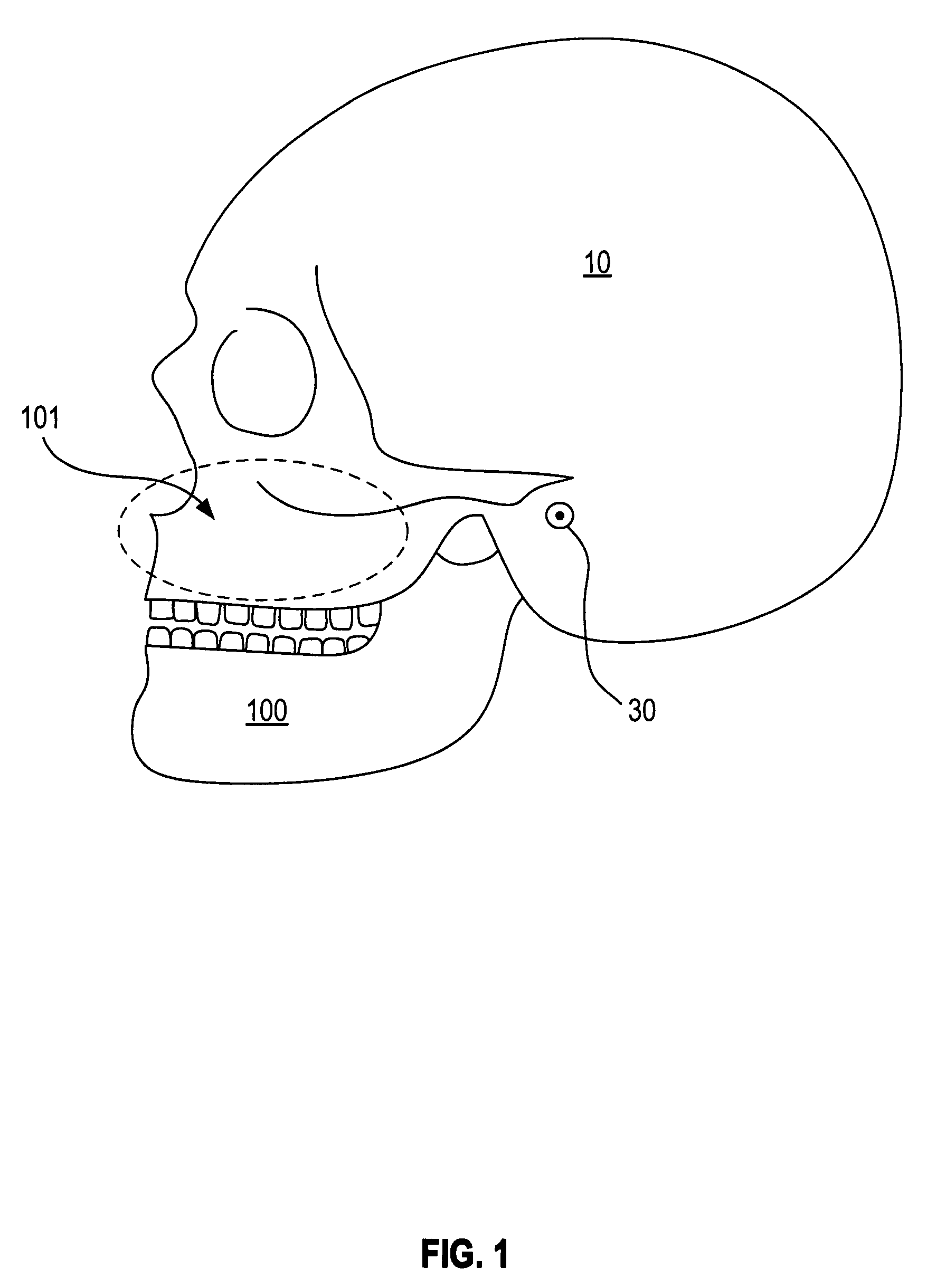 Active attachments for interacting with a polymeric shell dental appliance