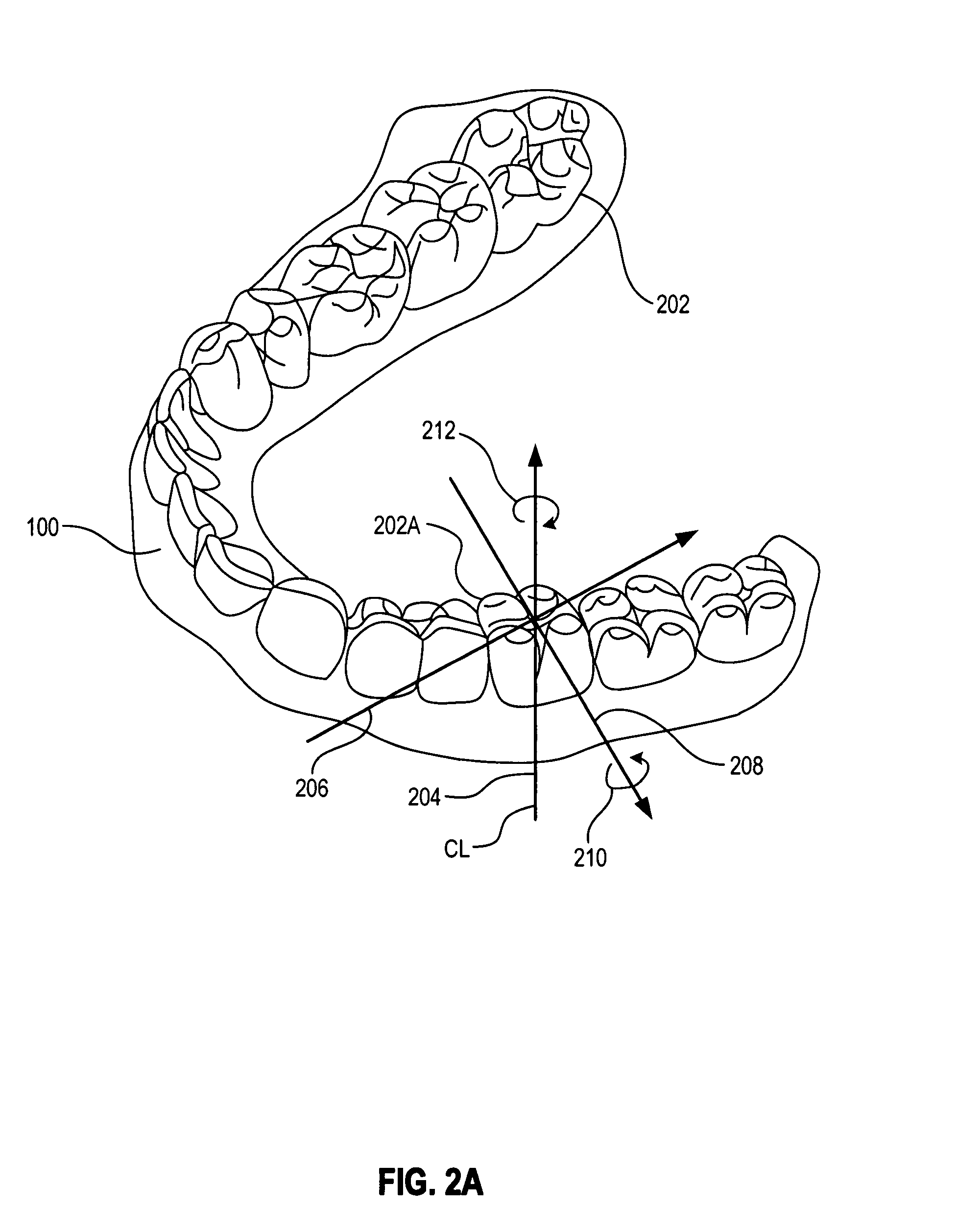 Active attachments for interacting with a polymeric shell dental appliance