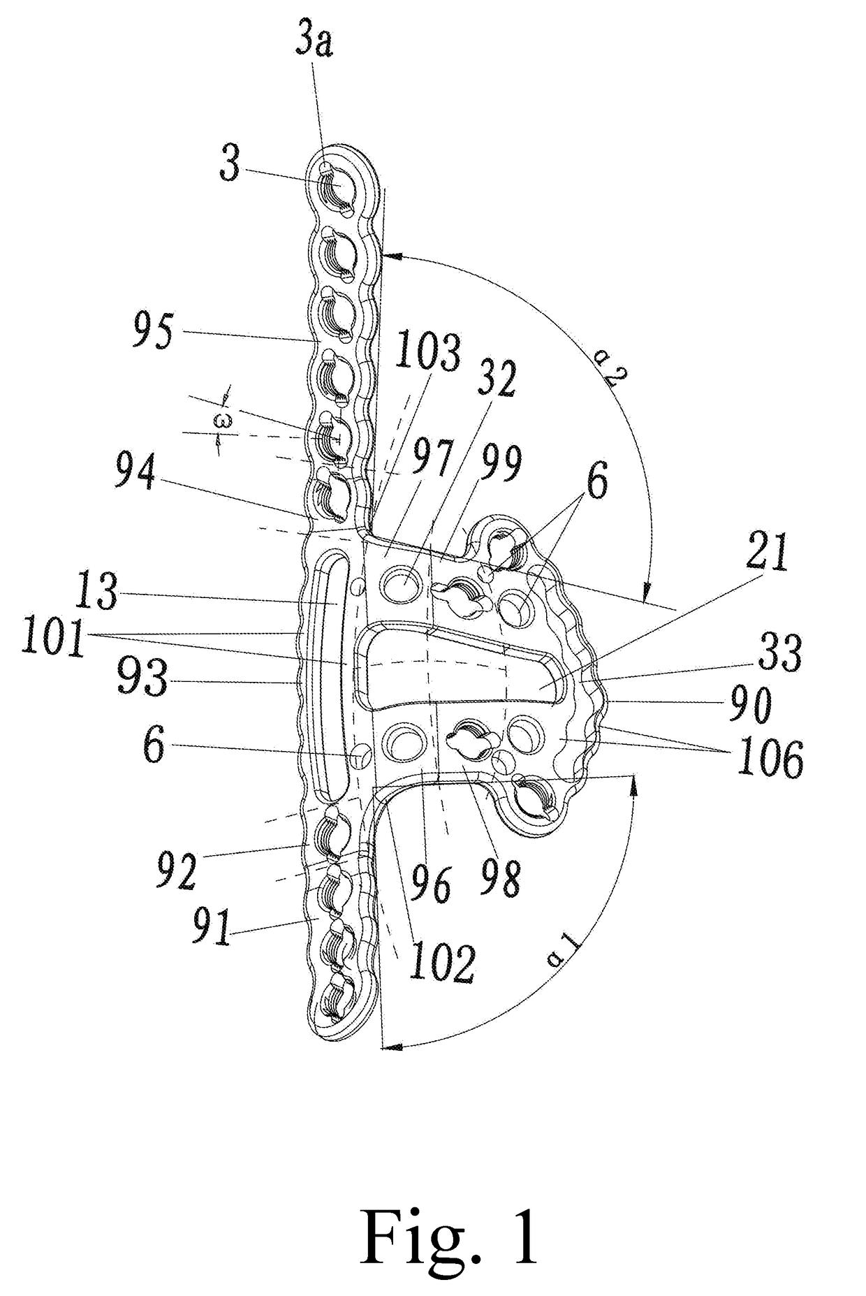 General anatomic self-locking plate for medial acetabulum and auxiliary apparatus thereof