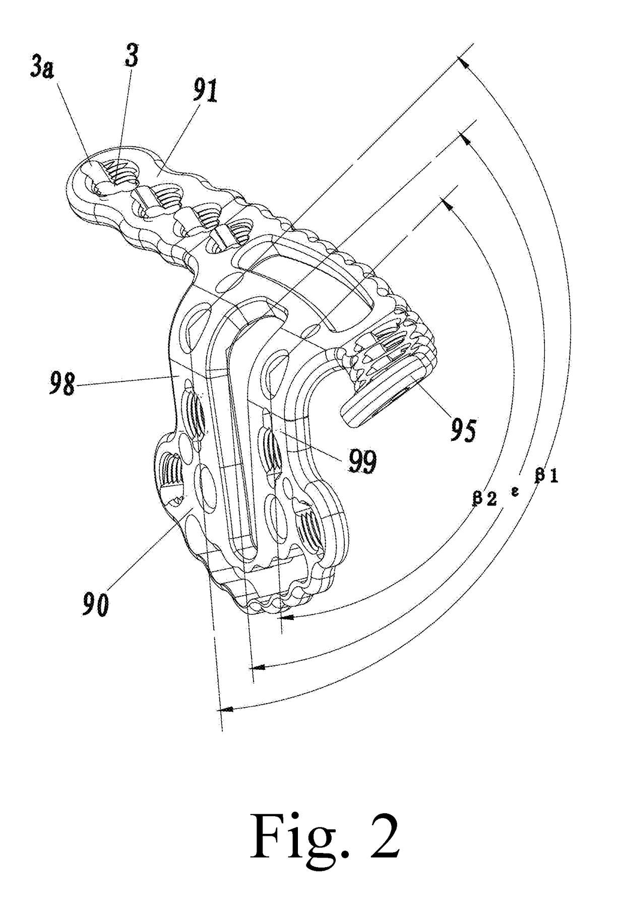 General anatomic self-locking plate for medial acetabulum and auxiliary apparatus thereof