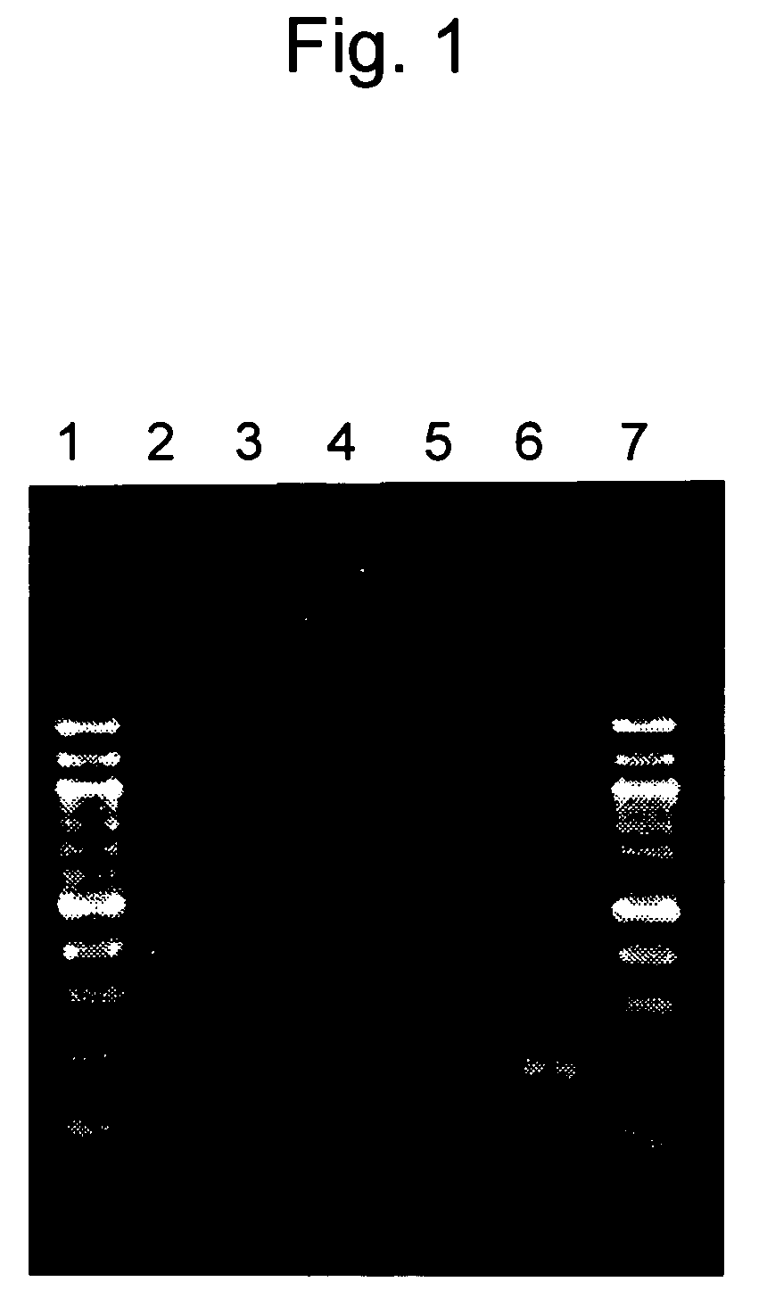 Method for detecting SARS coronavirus