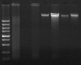 Detection method for BRAF gene mutation