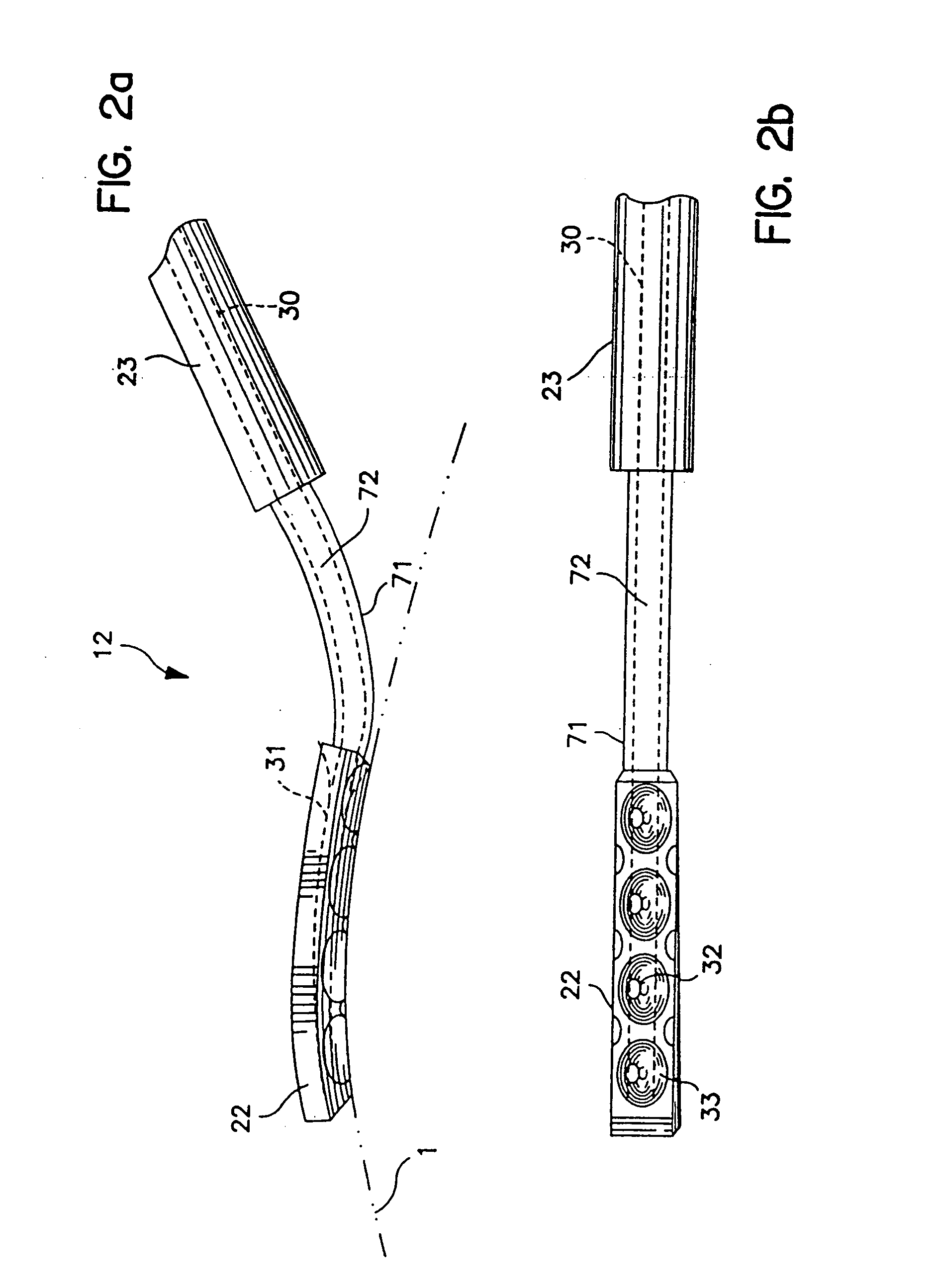Method and apparatus for temporarily immobilizing a local area of tissue