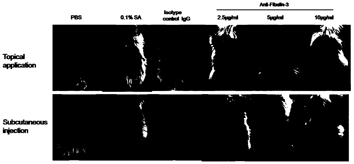 Application of fibulin-3 as a target in the preparation of drugs for preventing and treating psoriasis