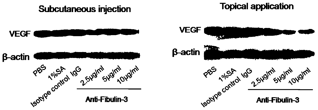 Application of fibulin-3 as a target in the preparation of drugs for preventing and treating psoriasis