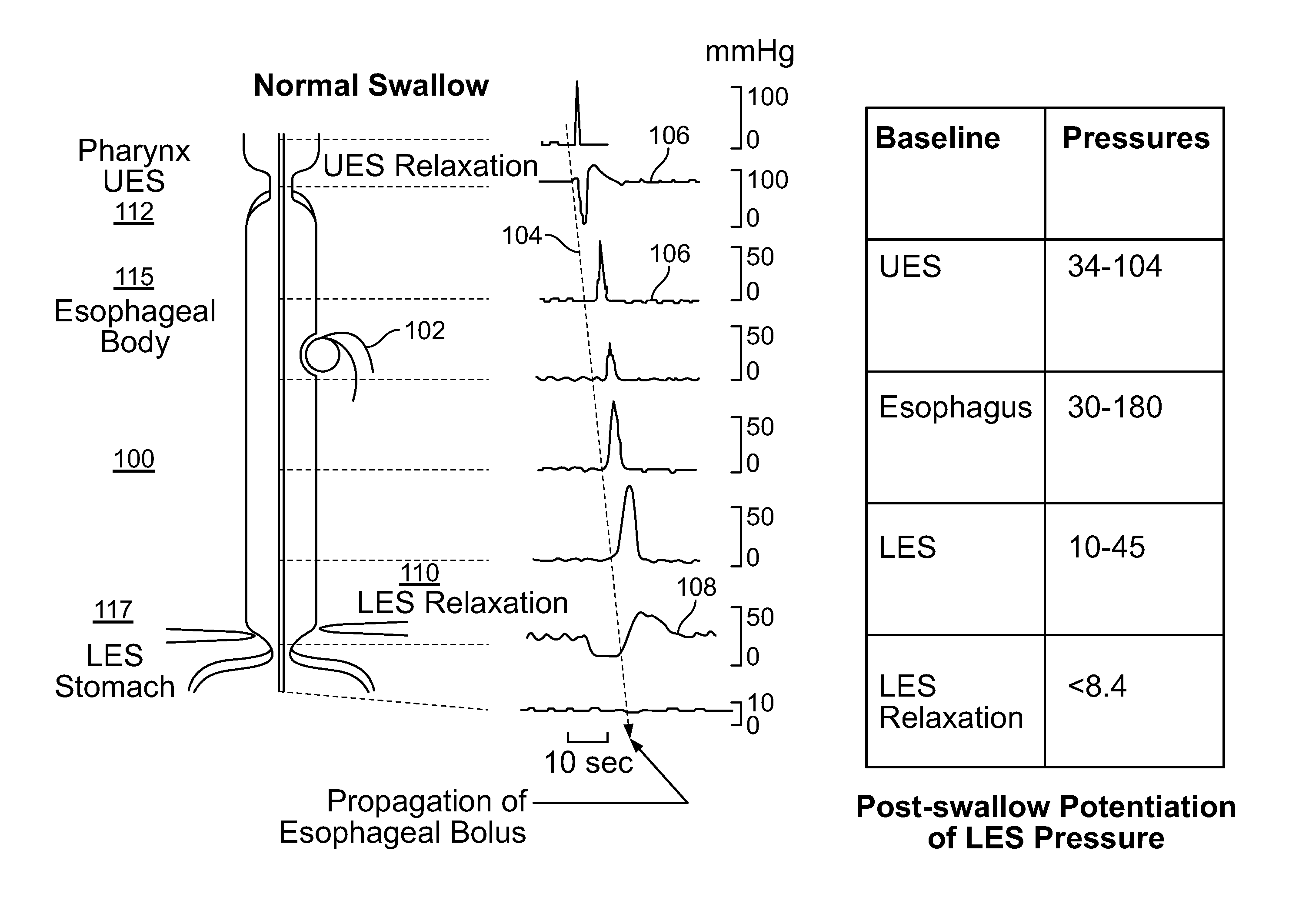 Device and Implantation System for Electrical Stimulation of Biological Systems