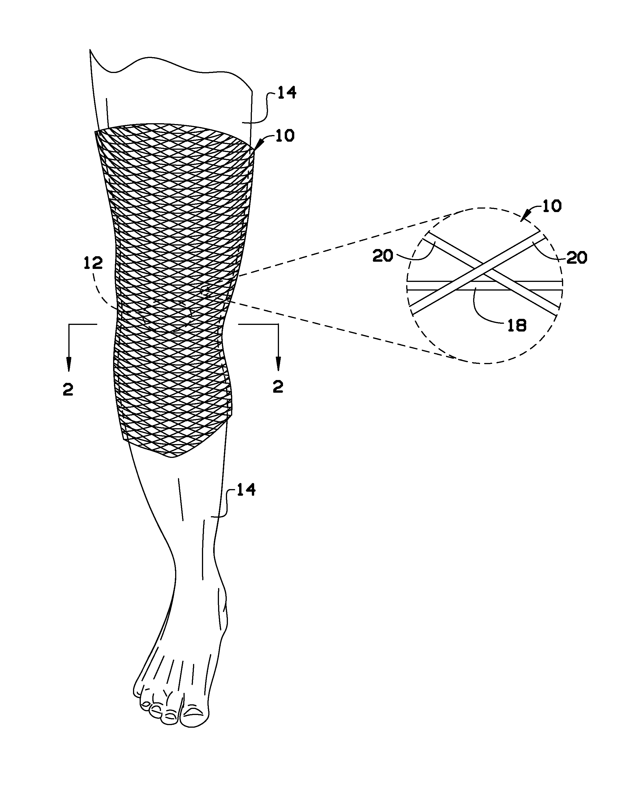 Joint support device