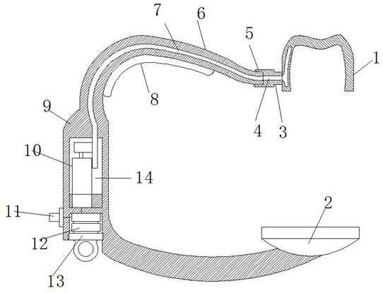 Orthodontic accelerator