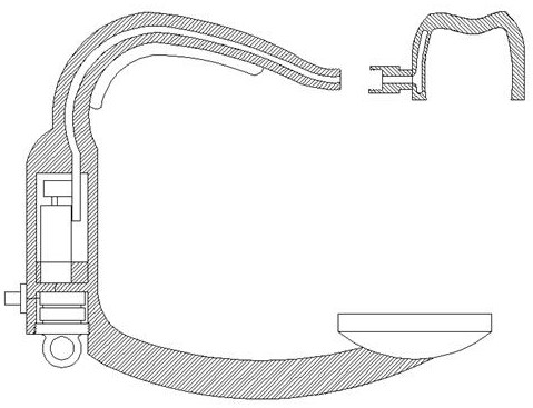 Orthodontic accelerator