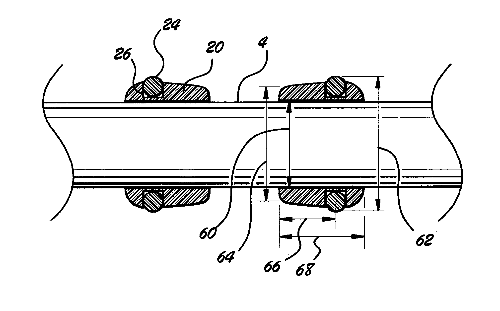 Ergonomic rings for drum sticks, method of installation, and method of use