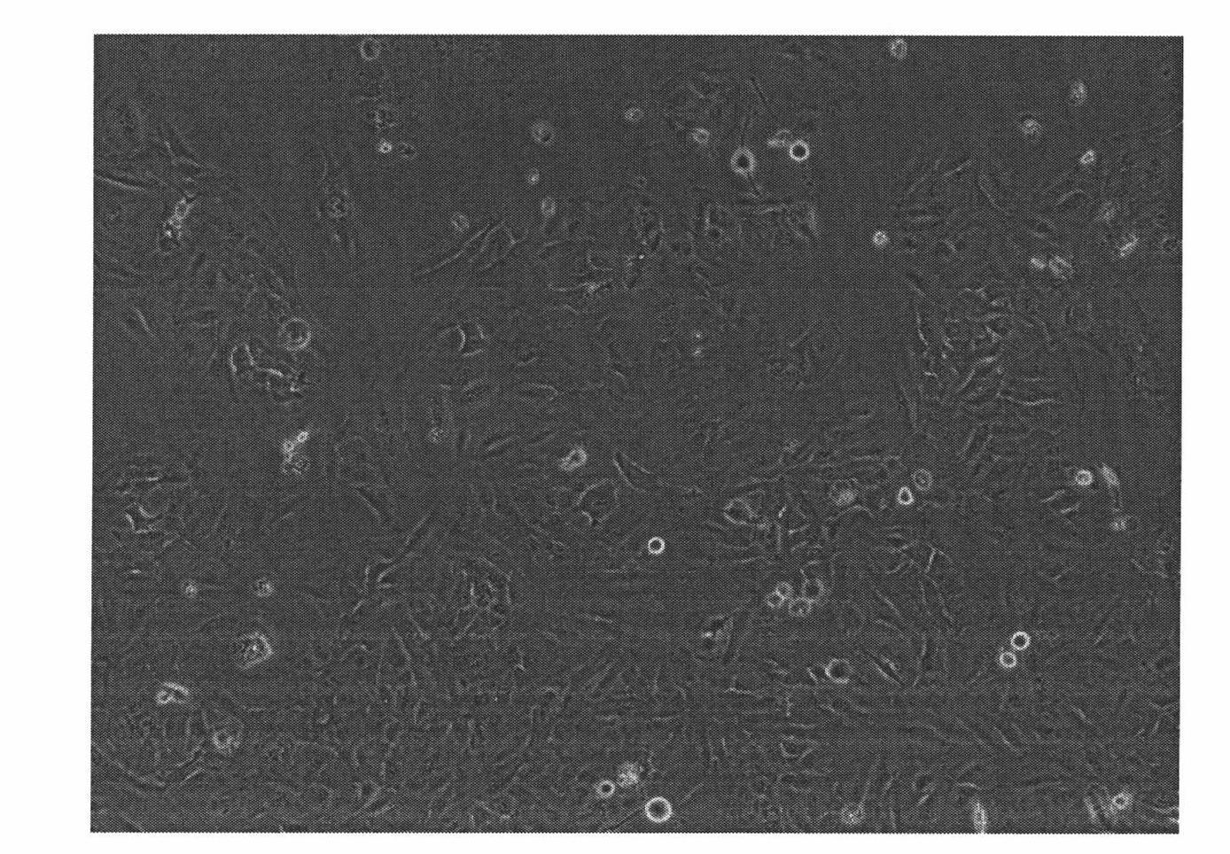 Human hepatoma carcinoma cell line and application thereof