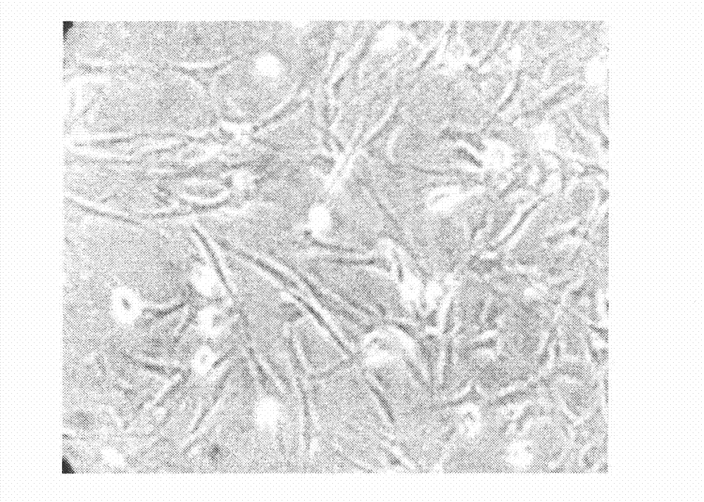 Kit for separating culture of olfactory ensheathing cells