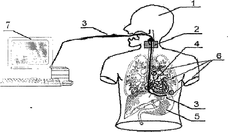 Transesophageal echocardiography visual simulation system and method