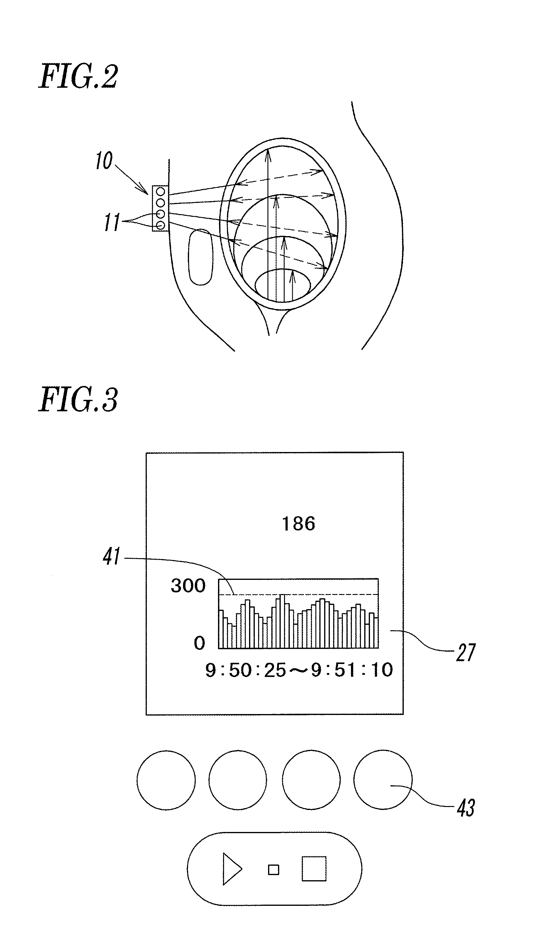 Ultrasonic urine volume measuring instrument, urine volume management data generating method using ultrasonic urine volume measuring instrument, and bladder training method using ultrasonic urine volume measuring instrument