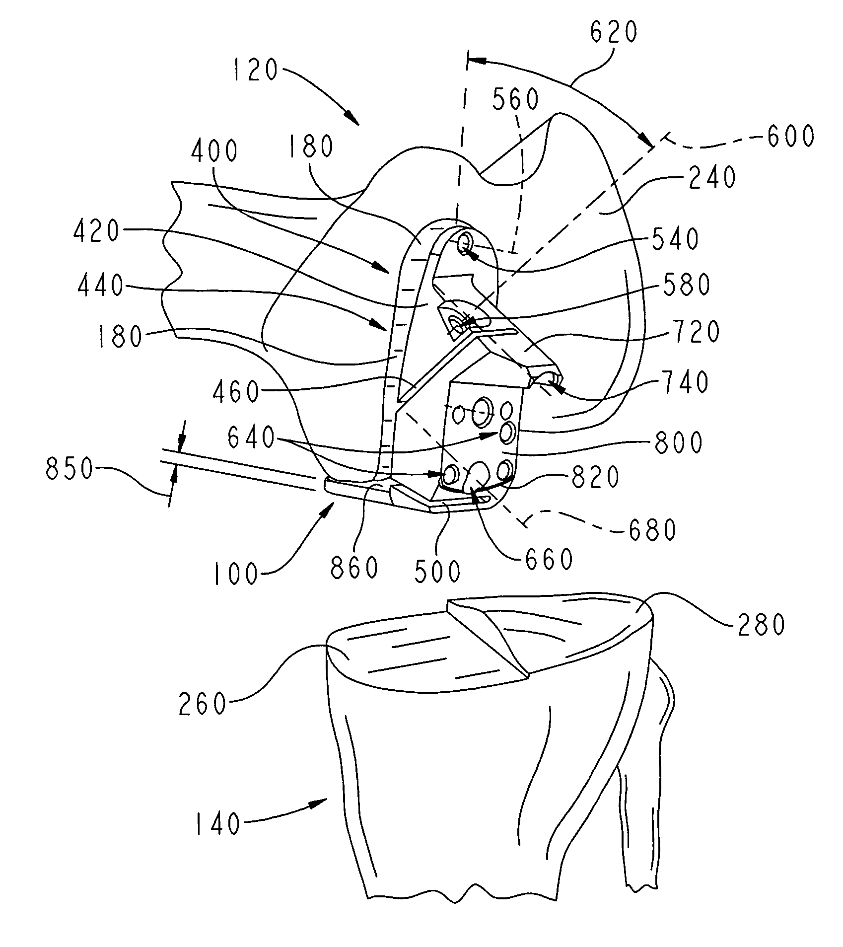Femoral resection guide apparatus and method