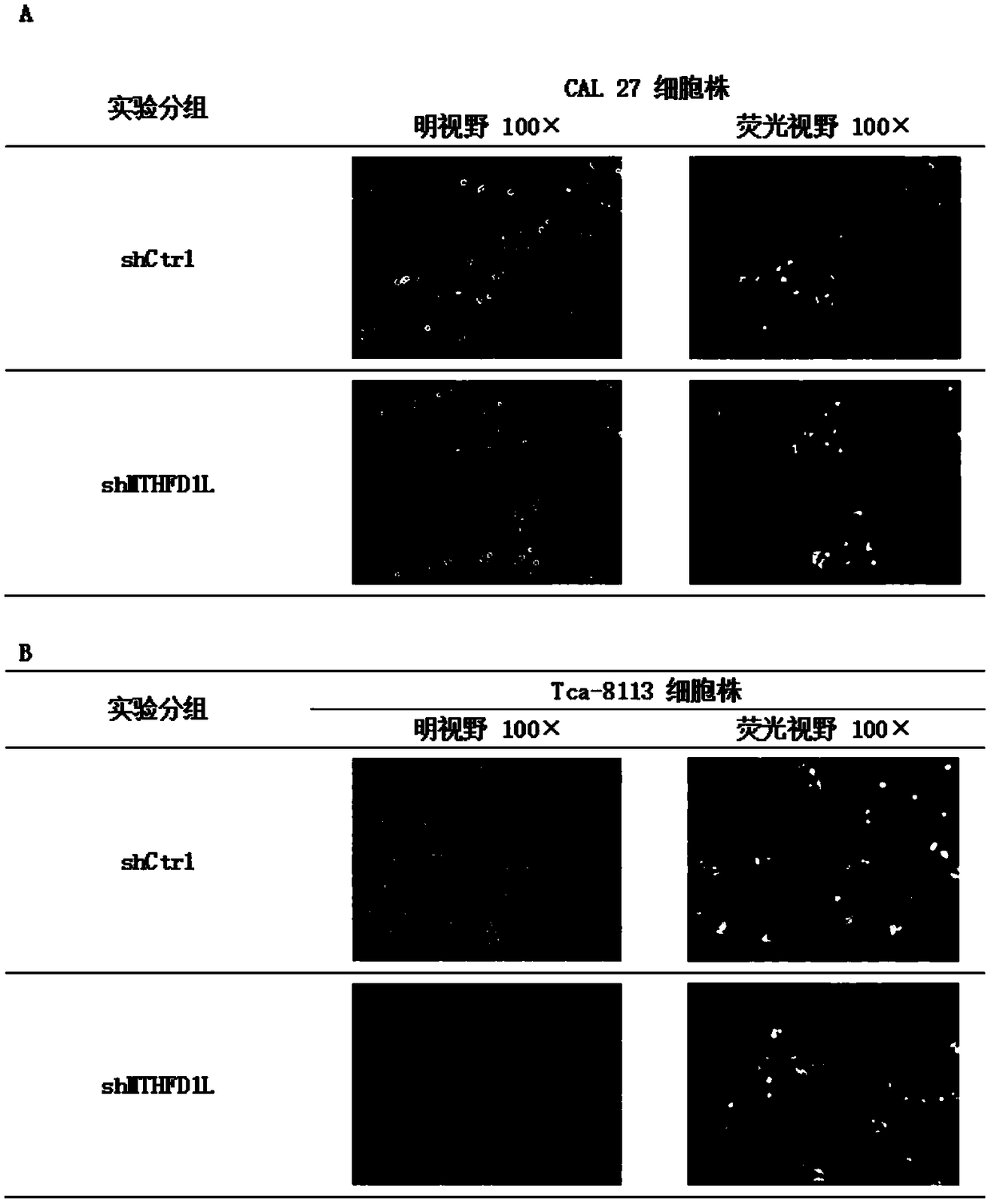 Application of MTHFD1L (methylenetetrahydrofolate dehydrogenase (NADP+dependent)1like) inhibitor to preparation of tongue squamous cell carcinoma treatment medicament